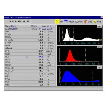 Analysator van het het Deel Veterinaire Bloed van Analyzer 3 van de open Systeem de Automatische Hematologie